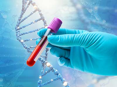 Hamburg Liquid Biopsy Seminar