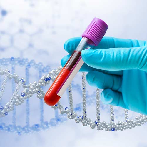 Liquid Biopsy